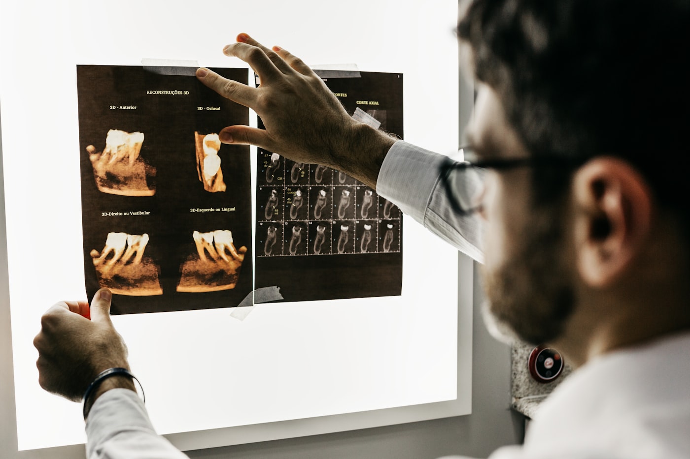 Person searching for a local physiotherapy clinic on a smartphone before booking an appointment